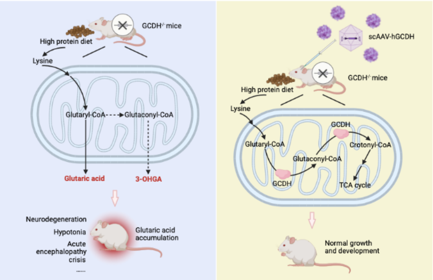 Promising Study Suggests That AAV Based Gene Therapy Can Treat Glutaric   Gas2 